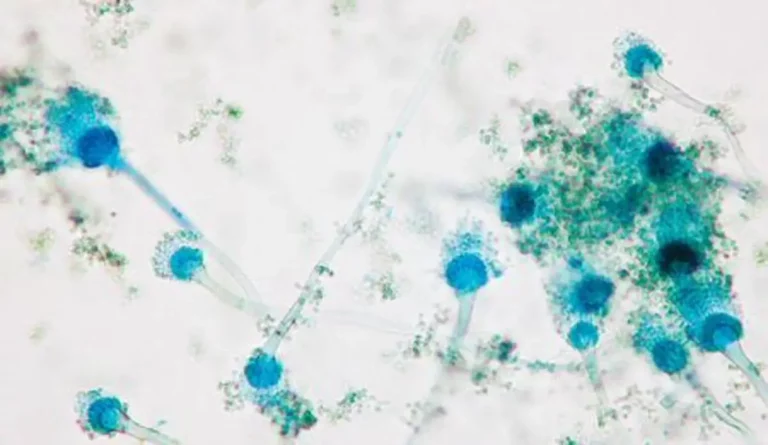 Skaisti zilie "ziedi" ir Aspergillus fumigatus sēne, kas tiek palielināta