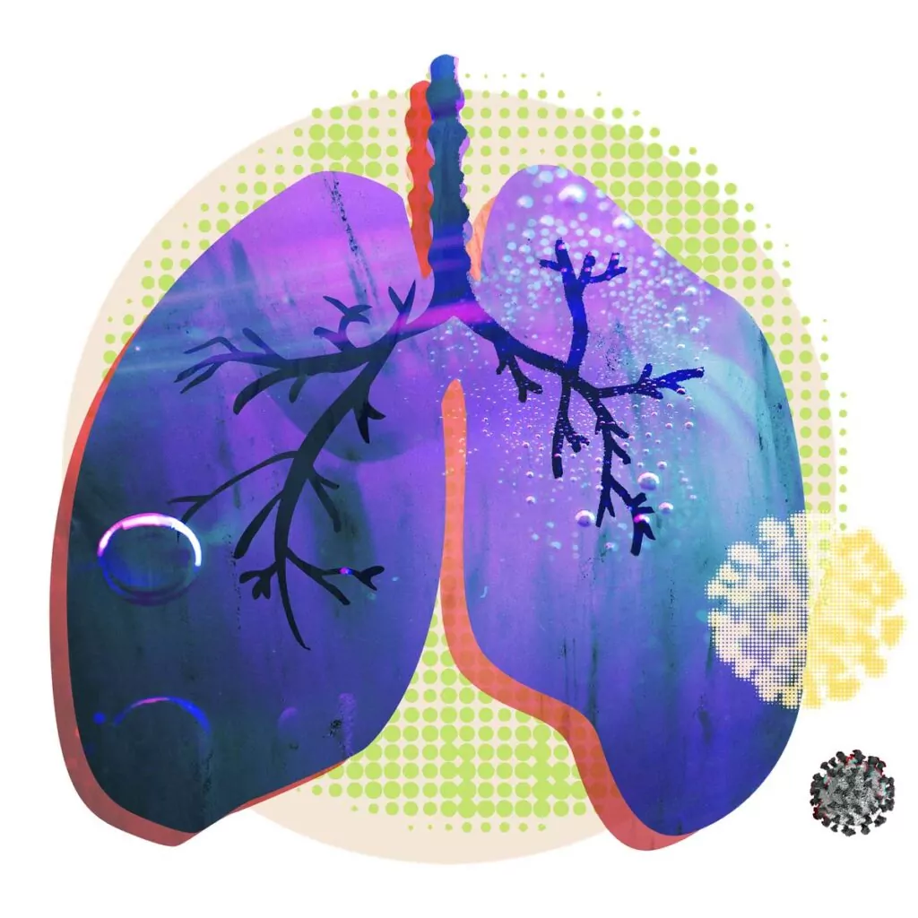 Corona lungs