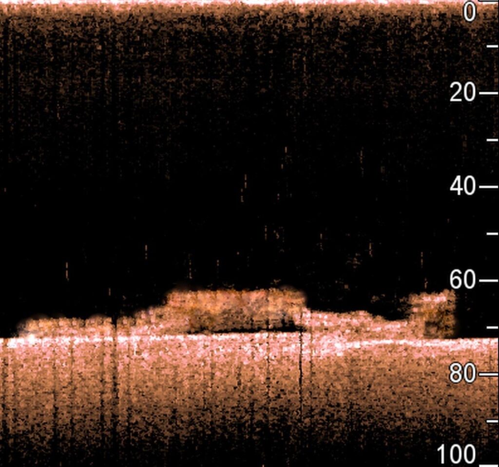 Hythe sonar billede