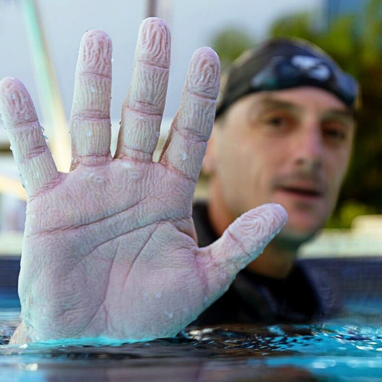 This is what hands look like after 24 hours in water (William Trubridge)