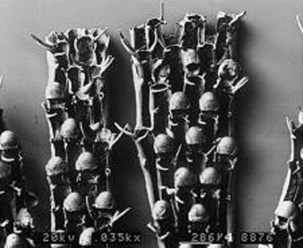 Through the Magnifying Glass: Bryozoans Marine Life Guide 1 Microscopic view of Bugula simplex autozooids with opercula, hoods, spines and avicularia – detail from bryozoans marine life guide